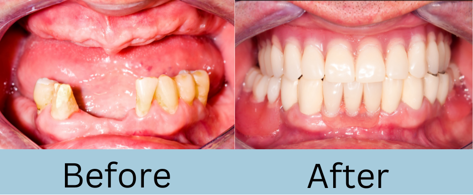 bradenton fl dentist
