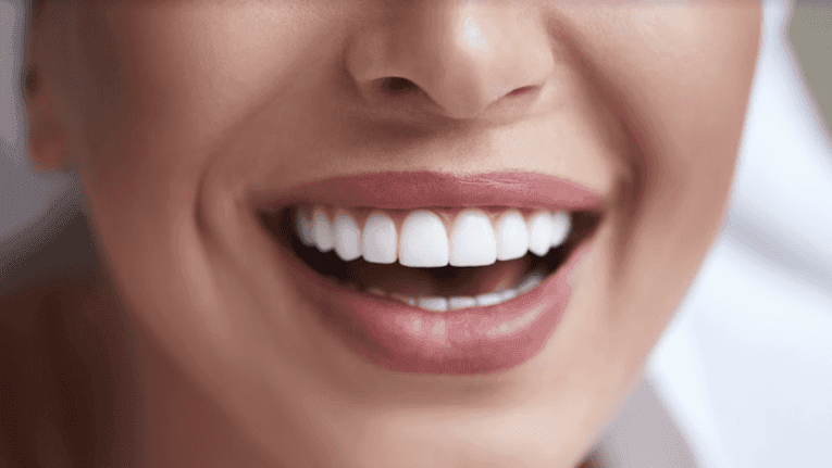 dental implants in bradenton fl