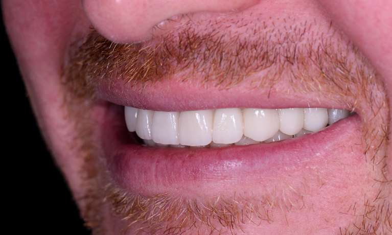 bradenton fl dentist