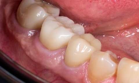 dentist in bradenton fl