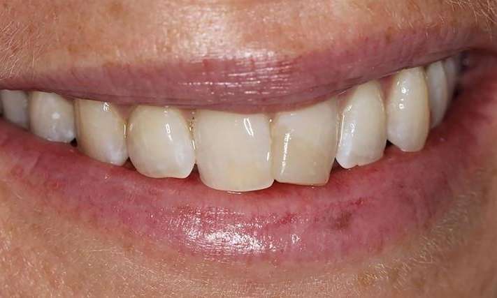 cosmetic dentist bradenton fl